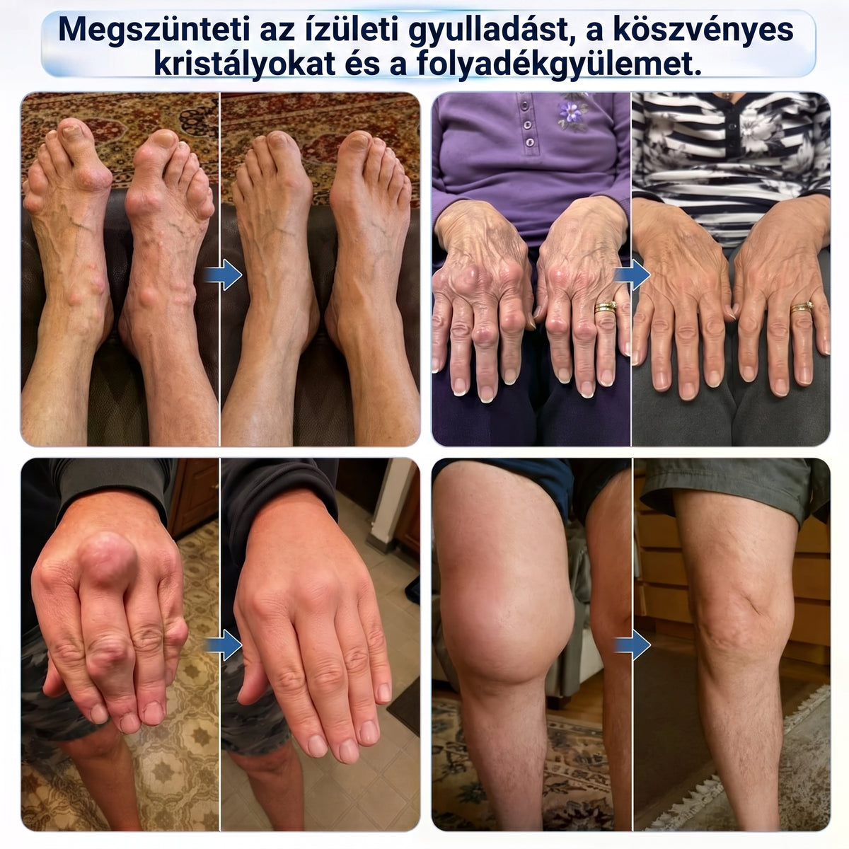 DR.HONOR® Mentol · Árnika · Ördögkarom 10 az 1-ben Ízület- és Izomápoló Roll-On | Köszvény, Ízületi Merevség, Duzzanat és Izomfájdalom Esetén | Gyorsan Felszívódó, Nem Zsíros