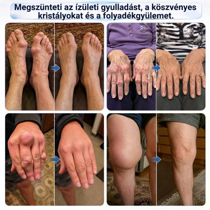DR.HONOR® Mentol · Árnika · Ördögkarom 10 az 1-ben Ízület- és Izomápoló Roll-On | Köszvény, Ízületi Merevség, Duzzanat és Izomfájdalom Esetén | Gyorsan Felszívódó, Nem Zsíros