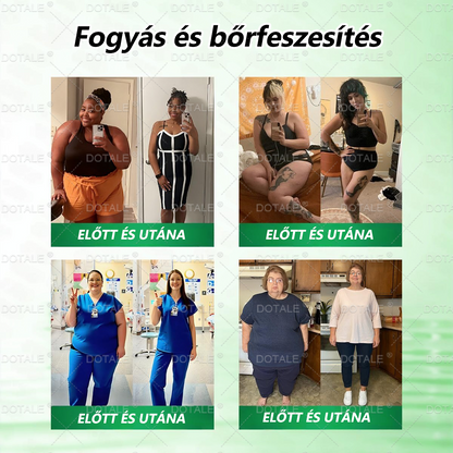 𝐃𝐑.𝐇𝐎𝐍𝐎𝐑® Csak 5 doboz maradt! Extra 30% kedvezményt biztosítunk! Formálja testét és őrizze meg egészségét. Ha most lemarad, csak jövő évben lesz újabb lehetősége.