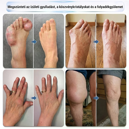DR.HONOR® Mentol · Árnika · Ördögkarom 10 az 1-ben Ízület- és Izomápoló Roll-On | Köszvény, Ízületi Merevség, Duzzanat és Izomfájdalom Esetén | Gyorsan Felszívódó, Nem Zsíros